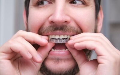 ¿Qué No Hacer con Ortodoncia Invisible?
