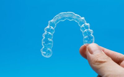 Tipos de Ortodoncia Invisible: ¿Cuál Es la Mejor para Vos?
