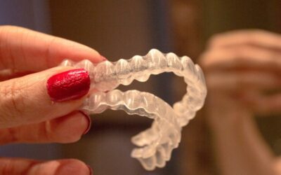 ¿Cómo Saber Si Mi Tratamiento De Ortodoncia Va Bien?