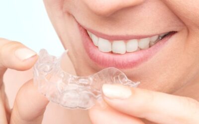 Ortodoncia Empresarial En Costa Rica: FabSmile Aligners